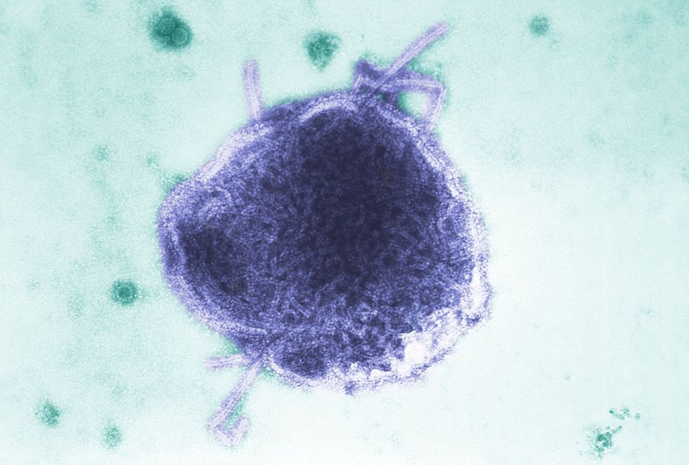two areas in england seeing ‘concerning’ rise in measles cases, ukhsa warns