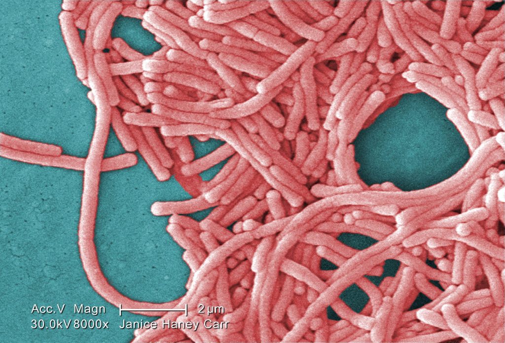 outbreak of legionnaires’ disease being investigated near downtown core in toronto