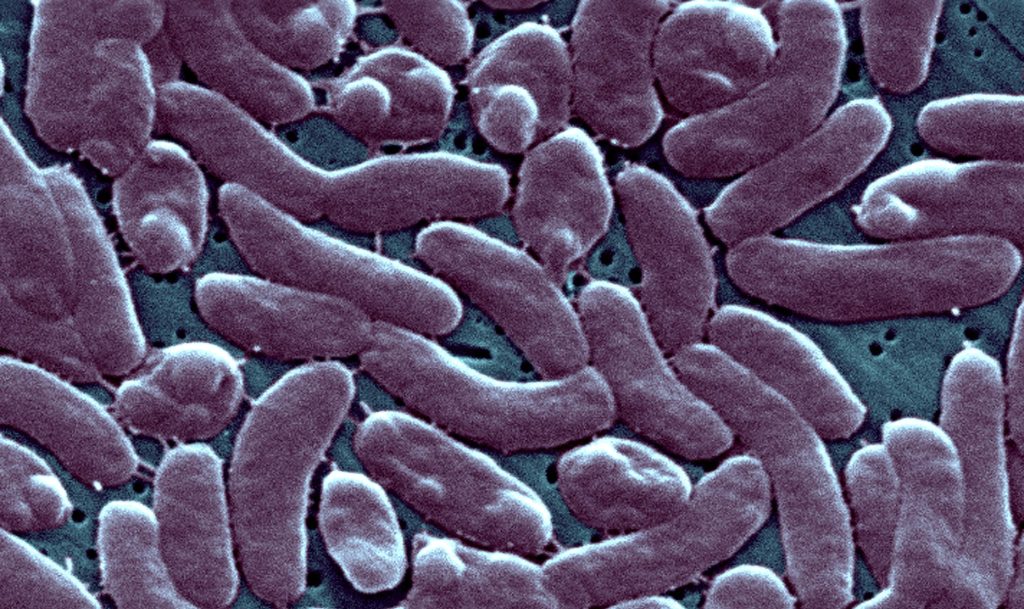flesh eating bacteria kills 5 in louisiana: what is vibrio vulnificus? what are the symptoms?