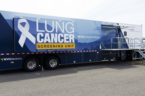 lucas to offer lung cancer screening in clarksburg
