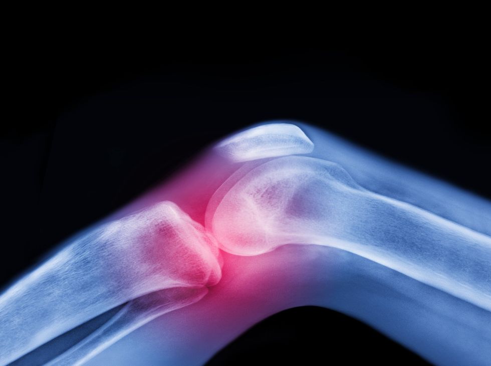 pain specialist reveals how to tell if you need ice or heat