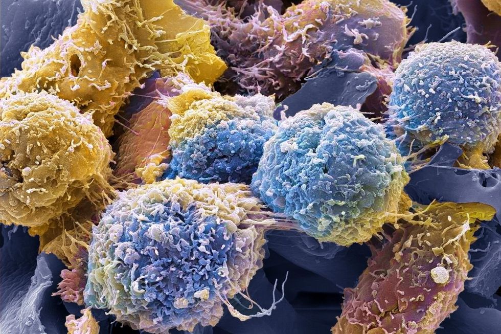 nhs to offer millions of women at home cervical screening kits for free
